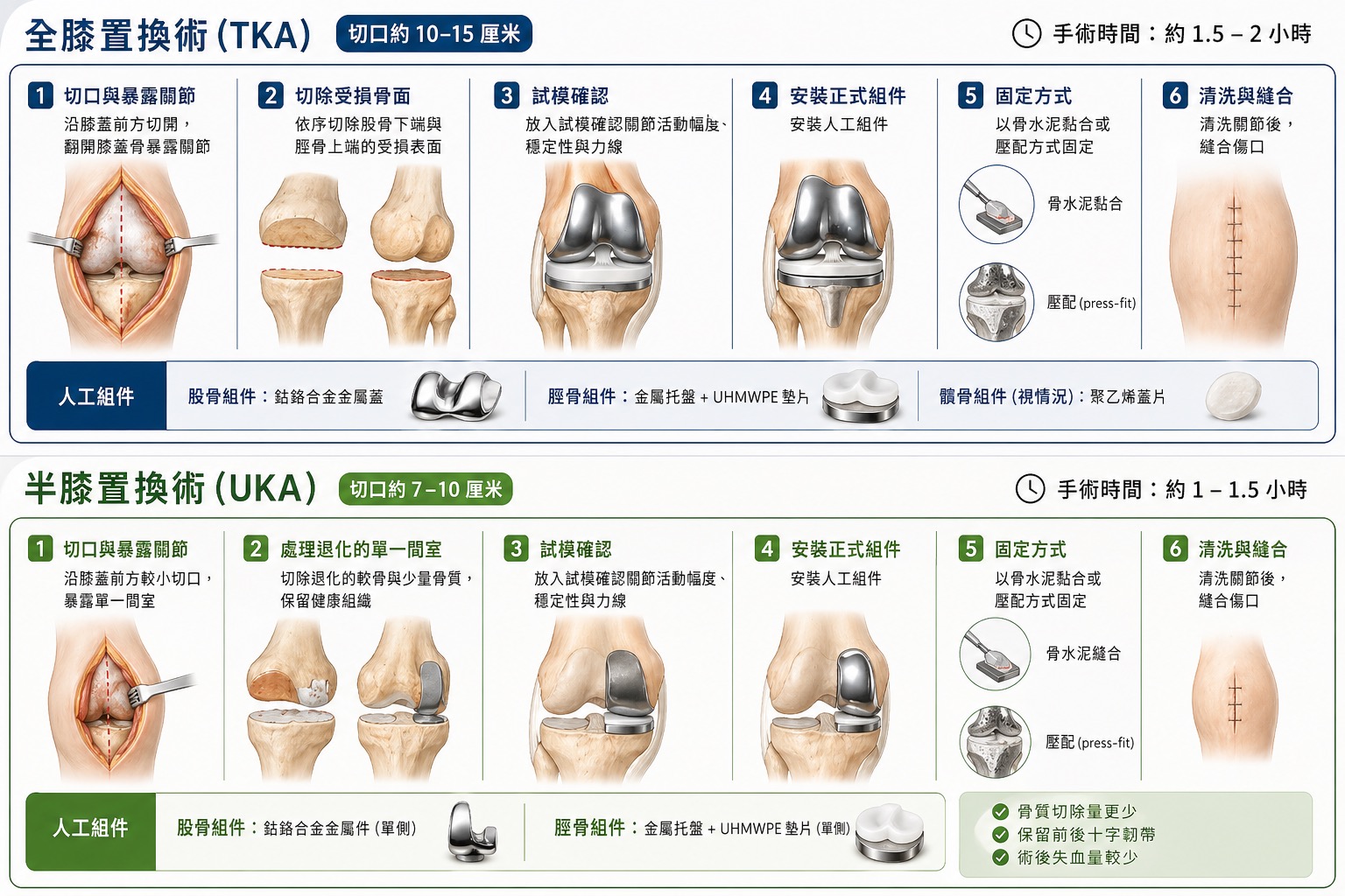 全膝置換術（TKA）與半膝置換術（UKA）手術步驟對比圖